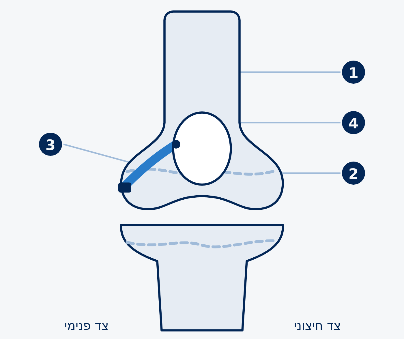 הרצועה הפנימית החדשה (בכחול), מהפיקה אל עצם הירך, מתחת ללוחית הגדילה.